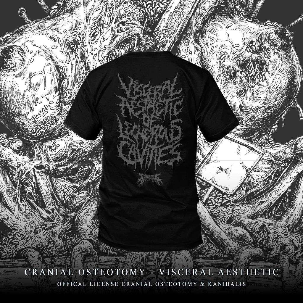 Pre-Order CRANIAL OSTEOTOMY - CRANIAL AESTHETIC
