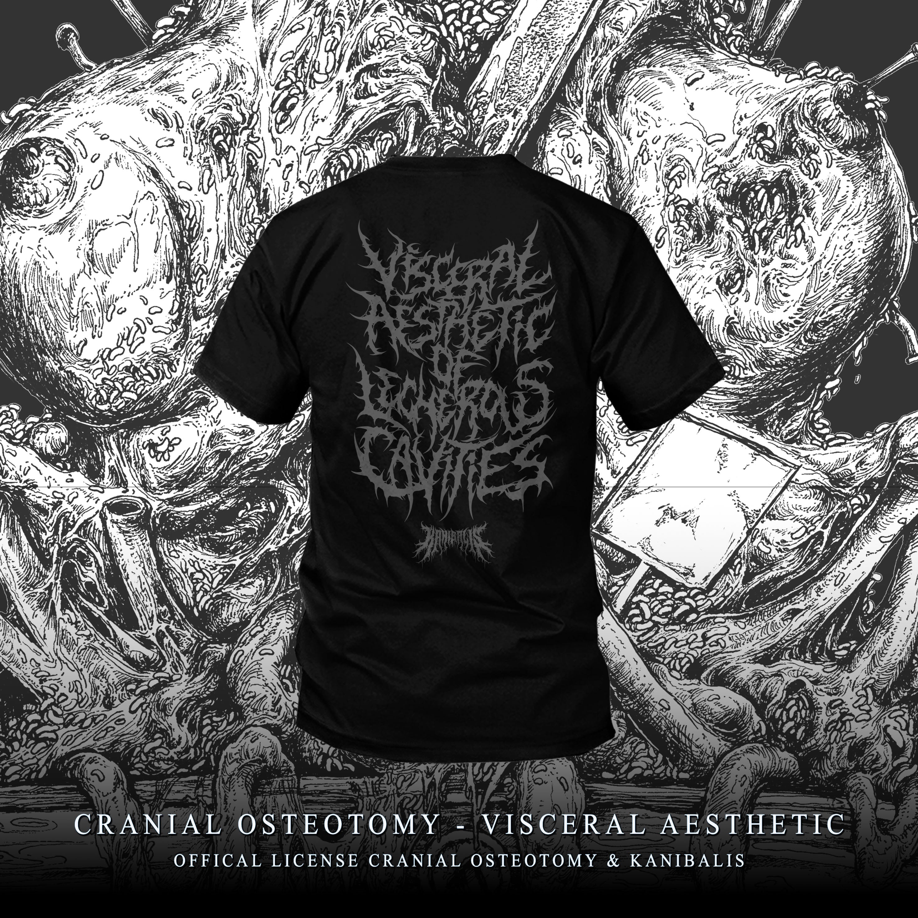 Pre-Order CRANIAL OSTEOTOMY - CRANIAL AESTHETIC