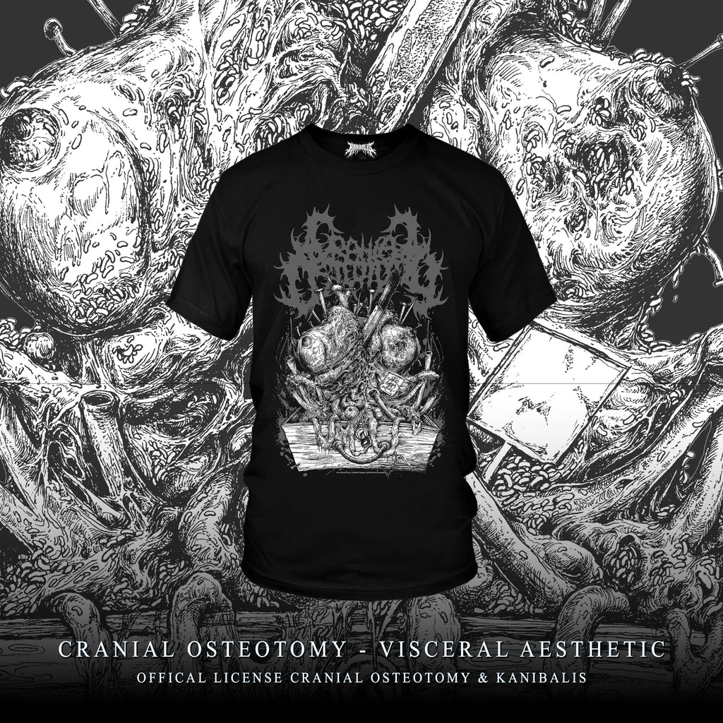 Pre-Order CRANIAL OSTEOTOMY - CRANIAL AESTHETIC