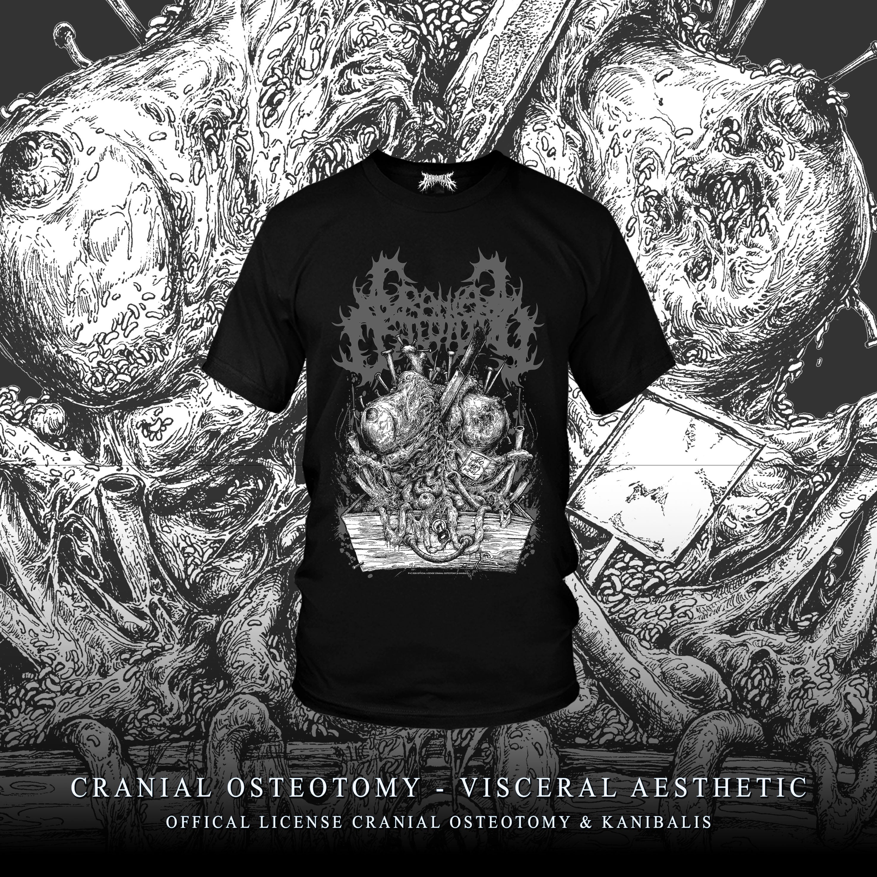 Pre-Order CRANIAL OSTEOTOMY - CRANIAL AESTHETIC