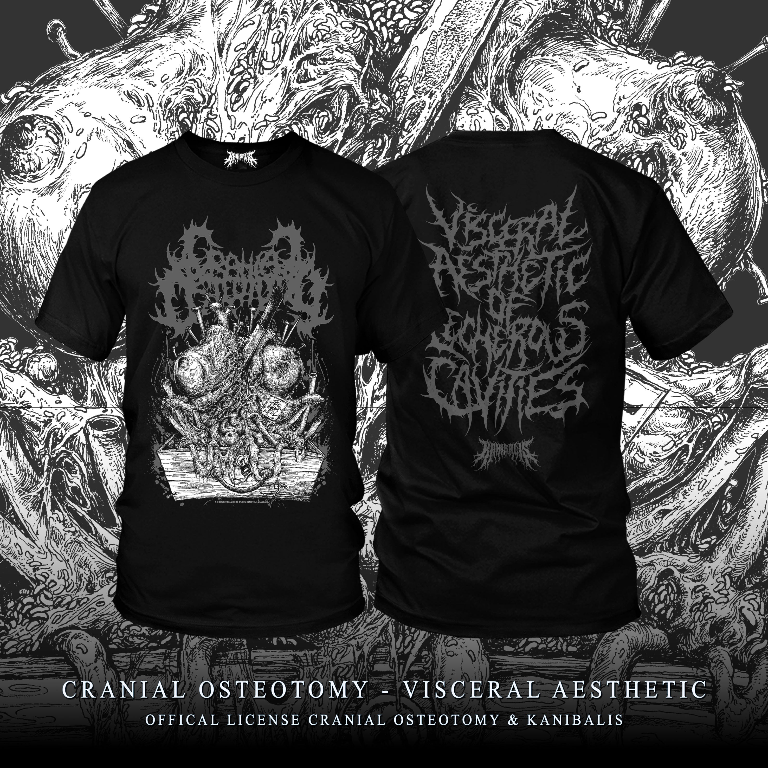 Pre-Order CRANIAL OSTEOTOMY - CRANIAL AESTHETIC